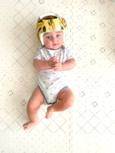 Our amazing baby helmet journey transformation and what you need to know now,